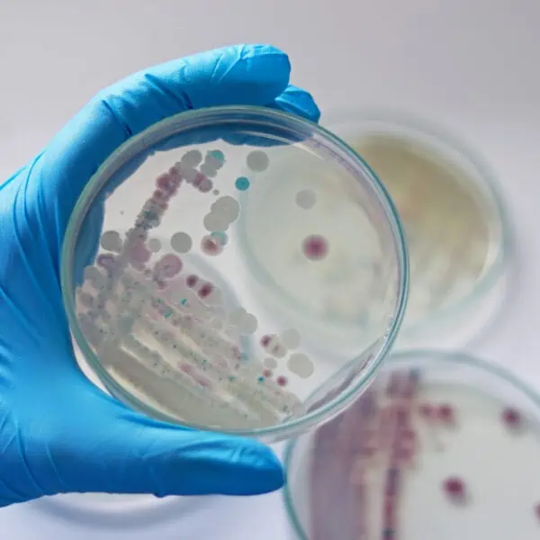 Advierten Sobre Bacteria Peligrosa en New York y Connecticut