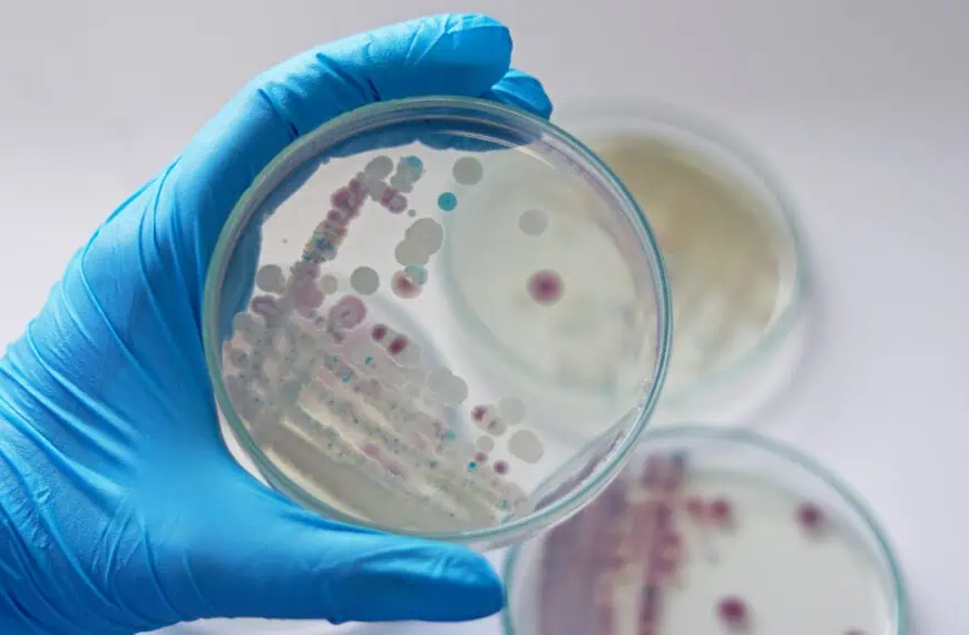 advierten sobre bacteria peligrosa en new york