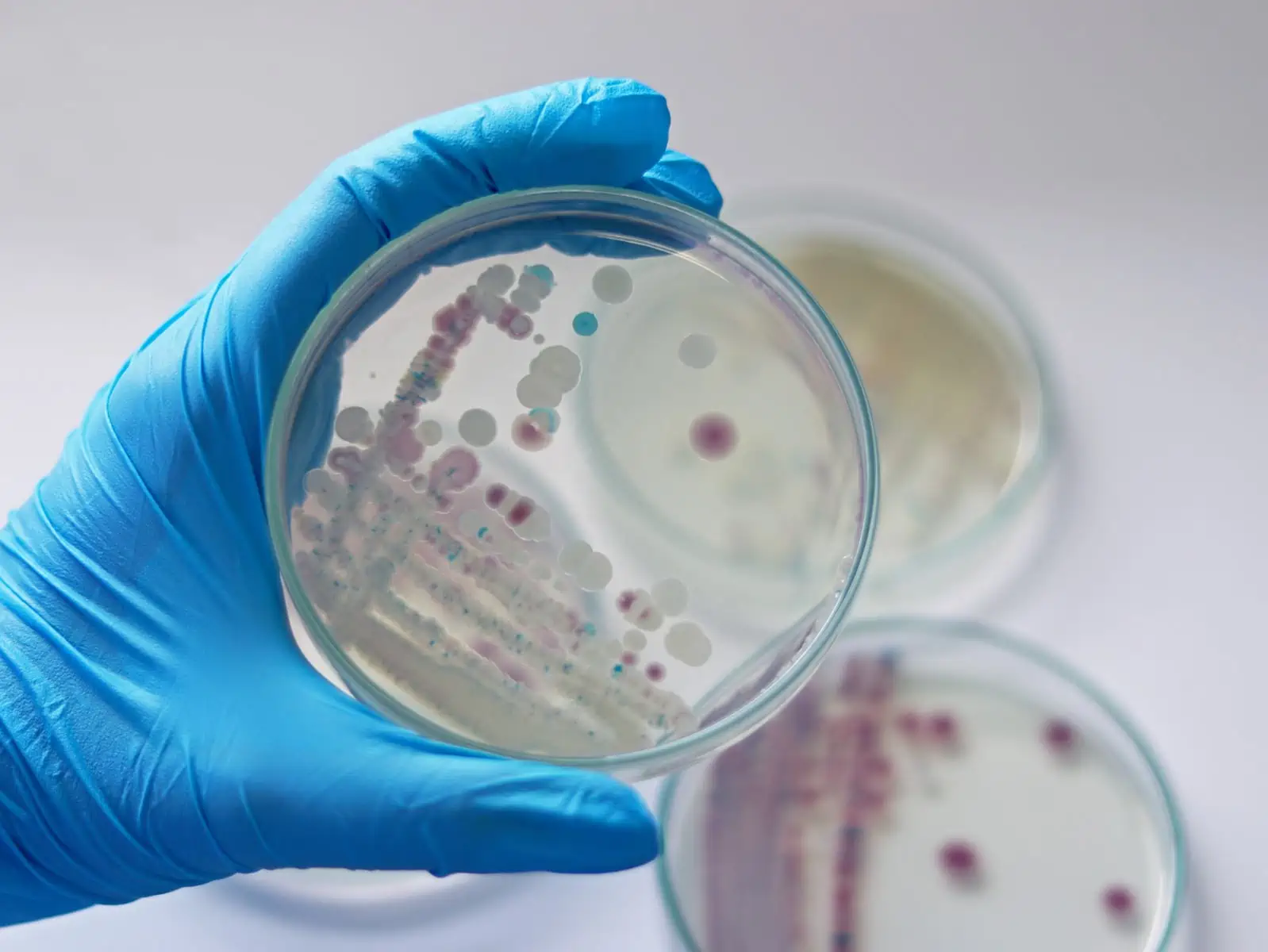 advierten sobre bacteria peligrosa en new york